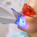 Teeth Whitening Techniques