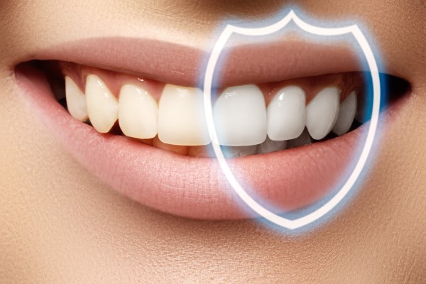 Tooth Whitening